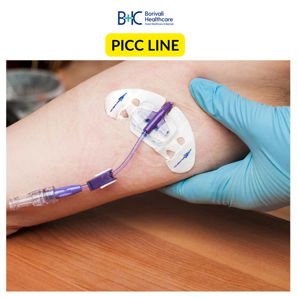 PICC line